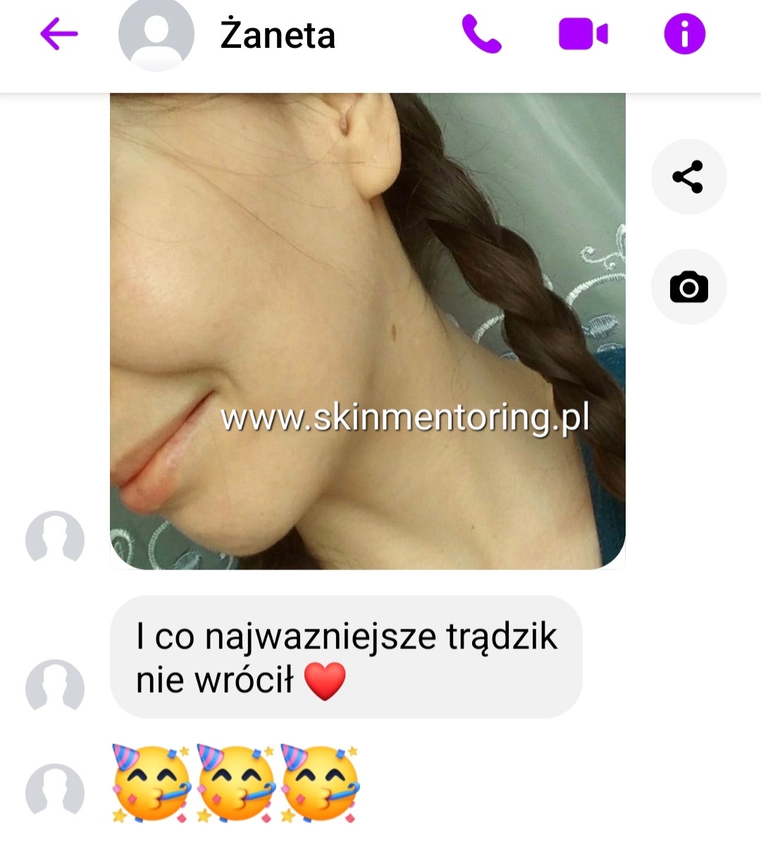 Zdjęcie produktu